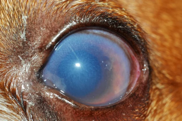 Edema corneale in corso di glaucoma Patologie oculari - Edema corneale in corso di glaucoma
