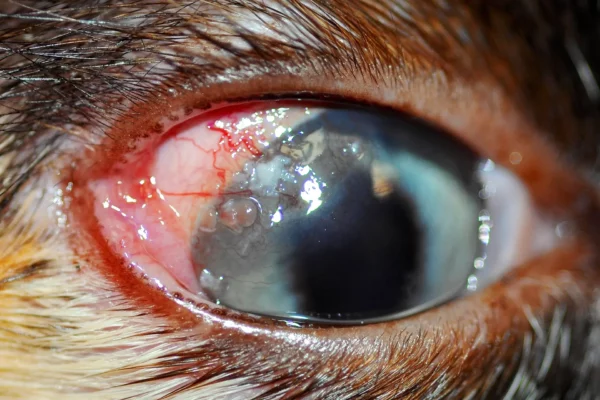 Infiltrati cellulari simil-caseosi in una forma classica di cherato-congiuntivite eosinofilica Infiltrati cellulari simil-caseosi in una forma classica di cherato-congiuntivite eosinofilica