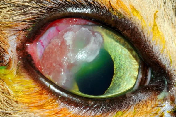 Infiltrati infiammatori associati a placca caseosa in una forma cronica di cherato-congiuntivite eosinofilica Infiltrati infiammatori associati a placca caseosa in una forma cronica di cherato-congiuntivite eosinofilica