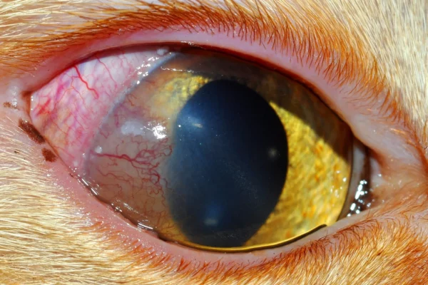 Neo-vascolarizzazione corneale ed infiltrati cellulari simil-caseosi in corso di cherato-congiuntivite eosinofilica Neo-vascolarizzazione corneale ed infiltrati cellulari simil-caseosi in corso di cherato-congiuntivite eosinofilica