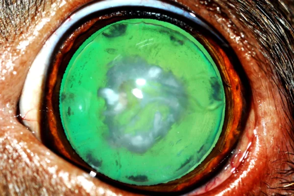 Cataratta immatura Patologie oculari - Cataratta immatura